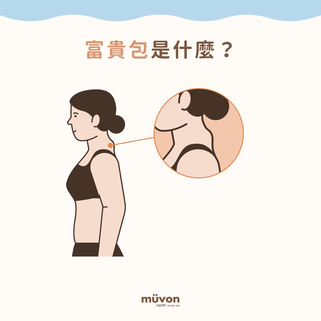 富貴包是什麼？